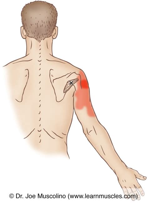 teres minor trigger point